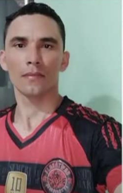 pha bong bang nguc 1